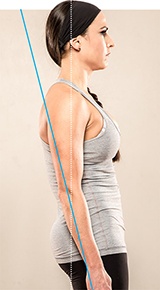 Posture disorders: stooped back