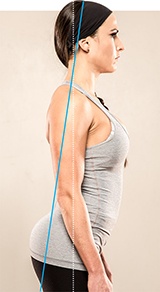 Posture disorders: lower cross syndrome